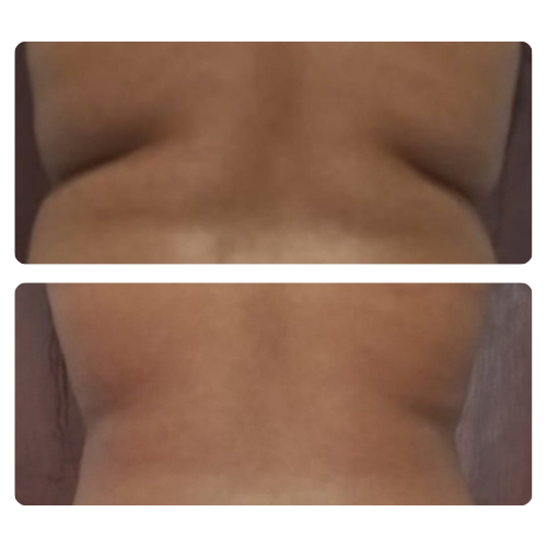 56
