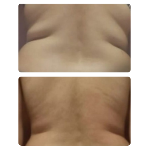 58